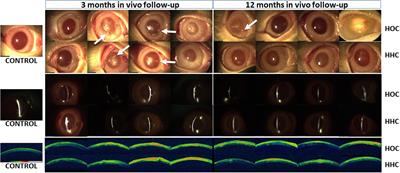 Long-Term in vivo Evaluation of Orthotypical and Heterotypical Bioengineered Human Corneas